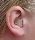 耳道式助聽器圖片/耳道式助聽器樣板圖 (2)