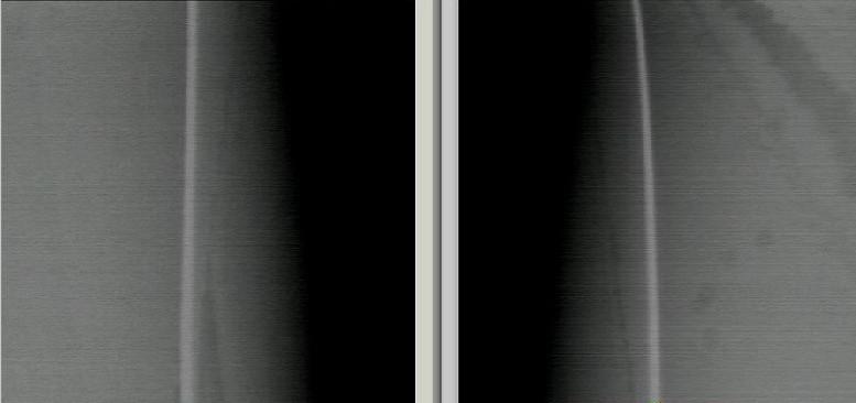 供應(yīng)陸銘光電高溫外窺工業(yè)電視 高溫外窺工業(yè)電視 高溫外窺工業(yè)電視