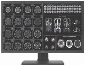 供应MRI显示器，魔言24寸一体化显示器，CT显示器,PACS显示器图片